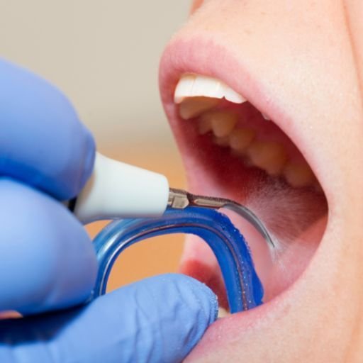 Limpieza-dental-1.jpg